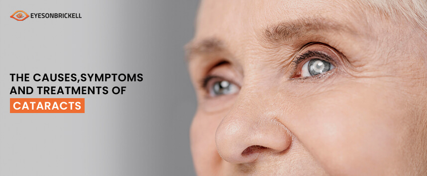 Eyes on Brickell: Cataracts: Causes, Symptoms, and Treatments
