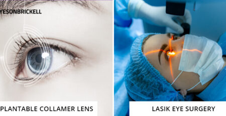 Eyes on Brickell: ICL-vs-Lasik